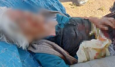 Niğde’de başıboş köpeklerin saldırdığı kadın ağır yaralandı