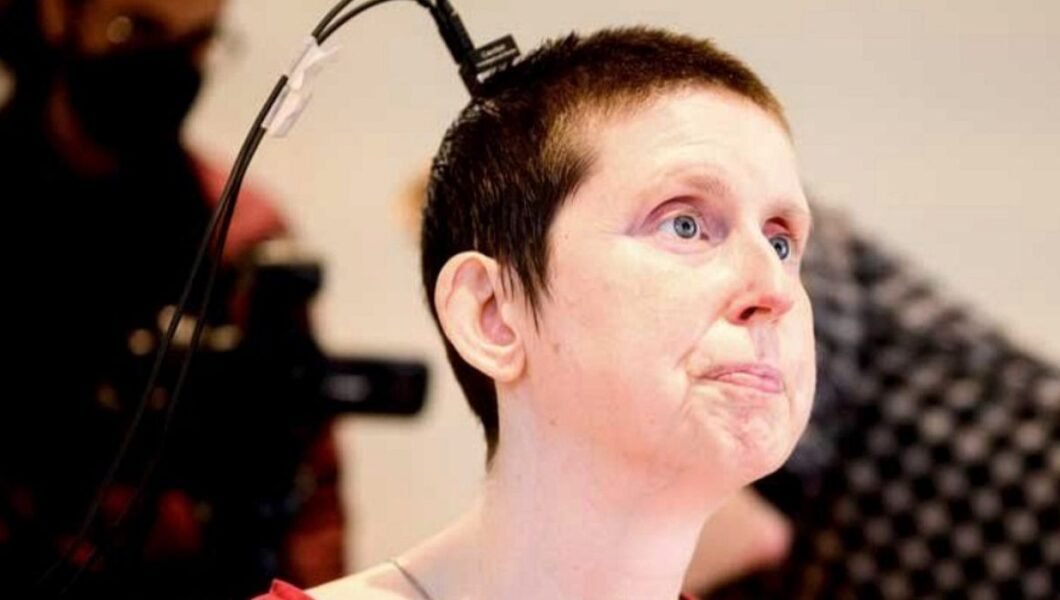 Deneysel beyin-bilgisayar implantı, felçli hastanın konuşmasına yardımcı oldu
